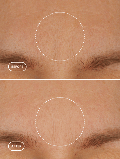 Retinol Alternative Moisturiser